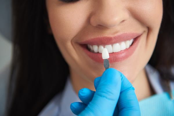 Visiting A Cosmetic Dentist: From Beginning To End