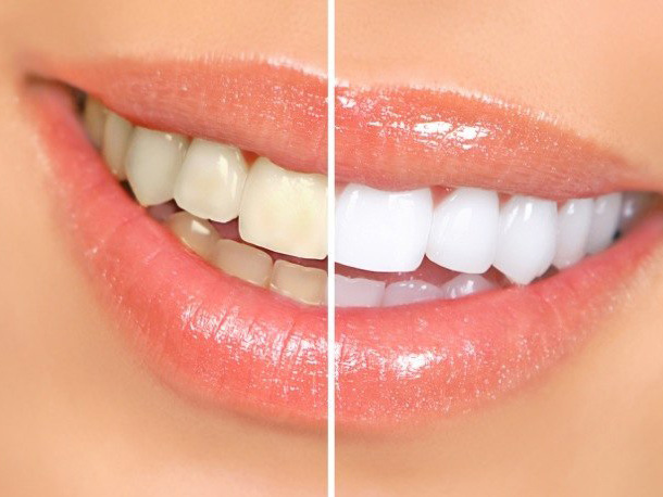 Brimhall Dental Group