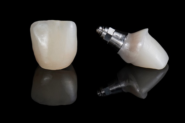 A Step By Step Guide To Getting An Implant Crown