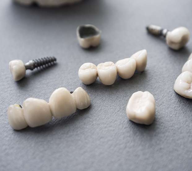 Bakersfield The Difference Between Dental Implants and Mini Dental Implants