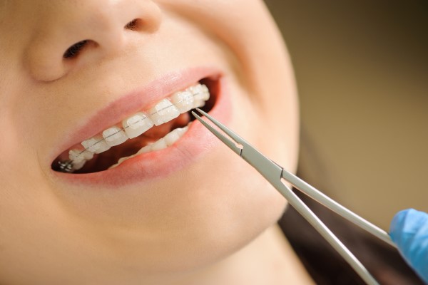 Common Treatments Used In Adult Orthodontics