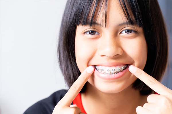 Commonly Asked Questions About Invisalign For Teens