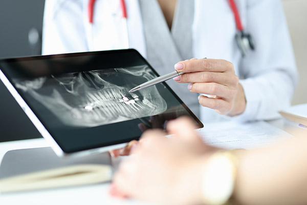 The Importance of Regular Dental Checkup X-Rays from Brimhall Dental Group in Bakersfield, CA