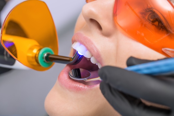 What Is The Process Of Getting Professional Teeth Whitening At The Dentist?
