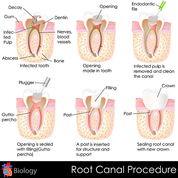 What Is Endodontics And How Can An Endodontist Save Your Teeth?