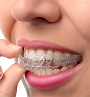 Clear Aligners - Almost Invisible Braces Bakersfield, CA