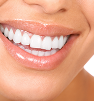 Teeth Whitening Services Bakersfield, CA