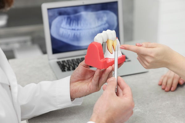 What To Expect During A Tooth Extraction: A Guide To A Smooth Recovery